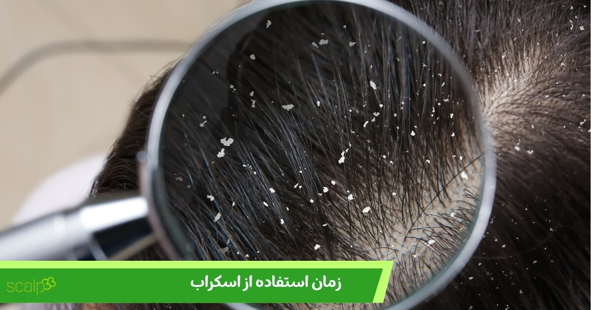 زمان استفاده از اسکراب 
