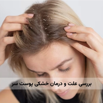 درمان خشکی پوست سر