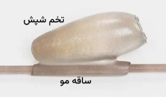 تخم شپش