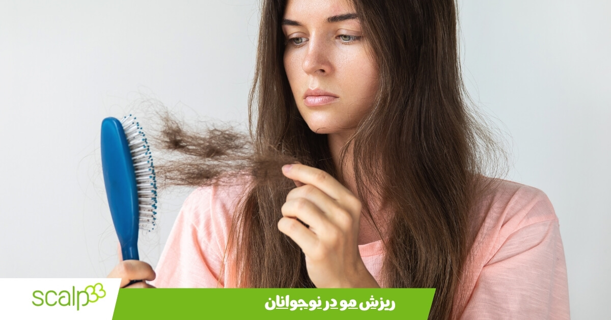 علت ریزش مو در سن 17 سالگی