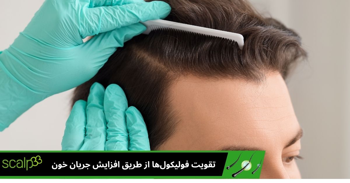 تقویت فولیکول ها