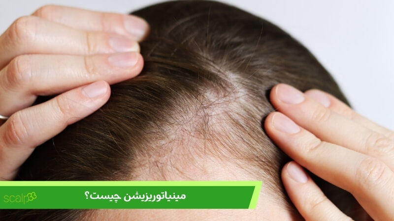مینیاتوریزیشن چیست؟