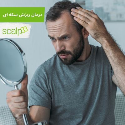 بهترین درمان ریزش سکه‌ ای